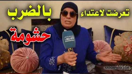 خطير..ريفية من الجالية تتعرض لاعتداء بالضرب من طرف أحد أقاربها لهذا السبب