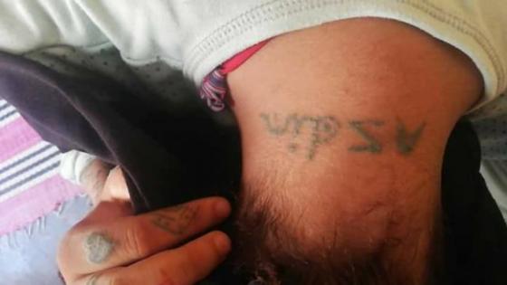 خبير تونسي في “التاتو” يعلن عن مبادرته لإزالة وشوم مغتصبي “خديجة”