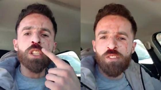 عاجل : بعد تحدثه عن ملفات ولوبي فساد بالحسيمة.. مستثمر شاب يتعرض للإعتداء بالضرب والجرح ويهدد بالإنتحار