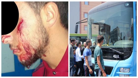 الاحتجاجات تتوسع.. طلبة بكلية الناظور يُقاطعون حافلات فيكتاليا تنديدا بالاعتداء الذي تعرض له طالب من طرف مراقب