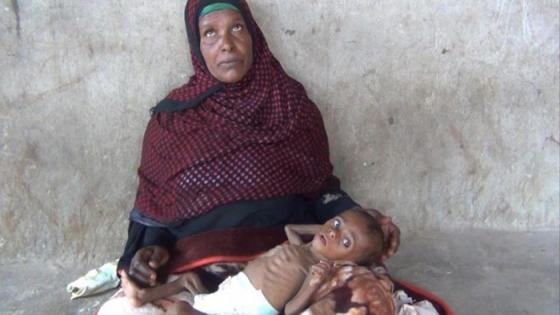 الأمم المتحدة: اليمن جحيم حي وطفل يموت كل 10 دقائق