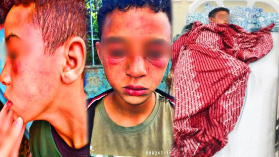 قاصر يتعرض لاعتداء جسدي ببن الطيب ومطالب بتوفير الحماية للأطفال