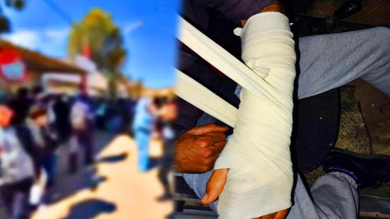 تدخل أب لحماية ابنته ينتهي باعتداء عنيف أمام إعدادية بن الطيب 2