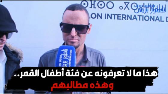 هذا ما لا تعرفونه عن فئة أطفال القمر.. وهذه مطالبهم